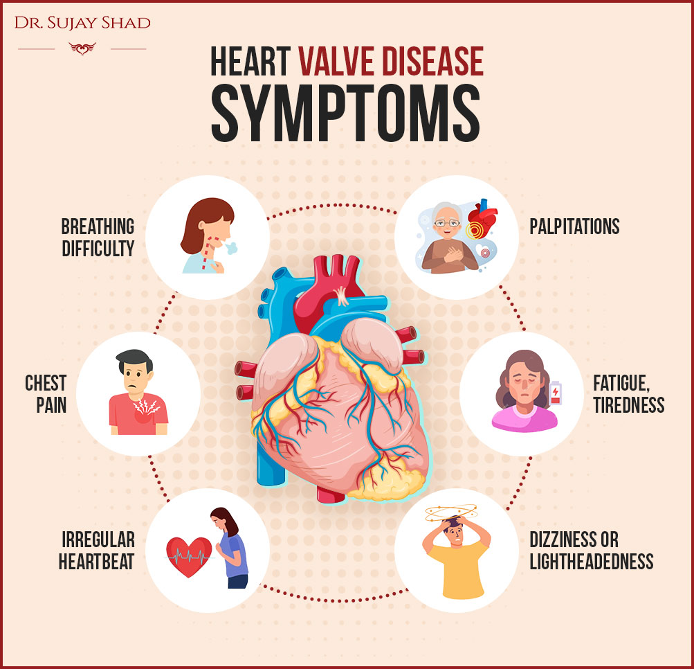 Common heart valve disease symptoms one should not ignore.
